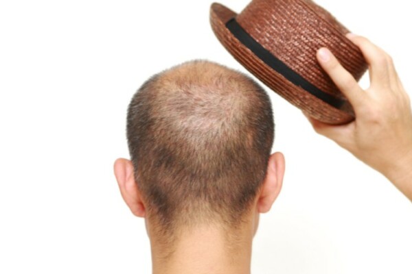 Bald man holding a hat above his head