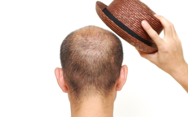 Bald man holding a hat above his head